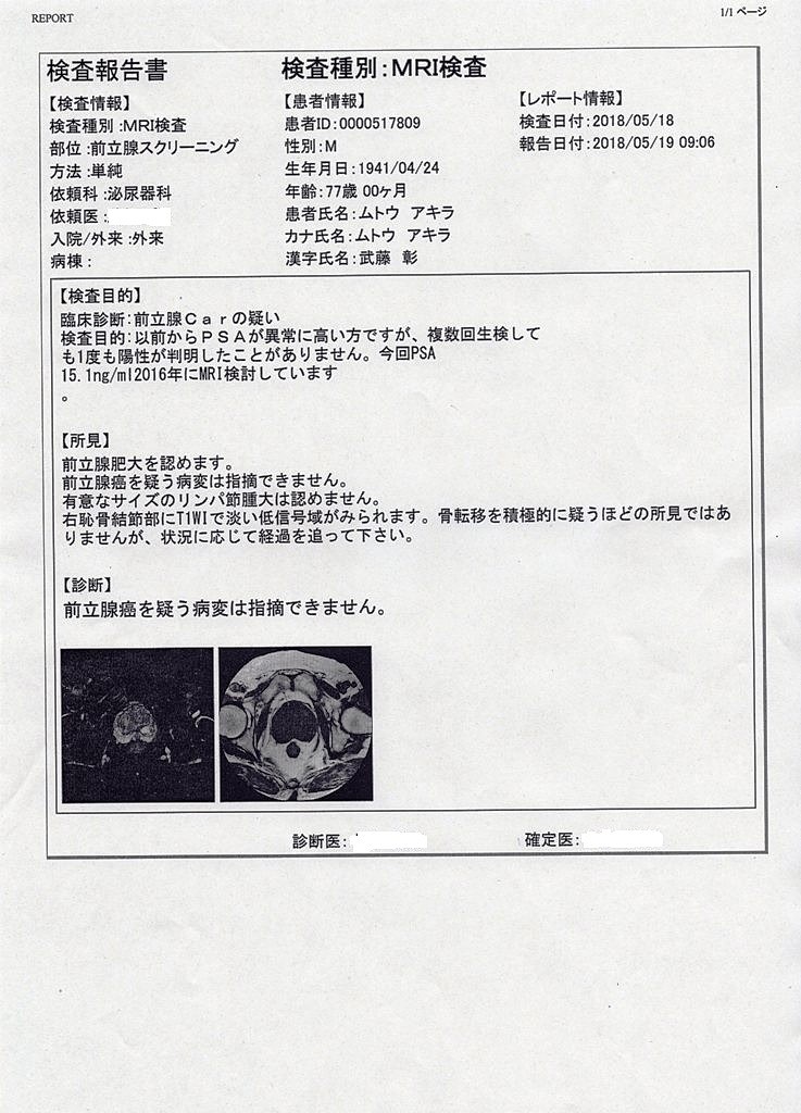 MRI検査-2